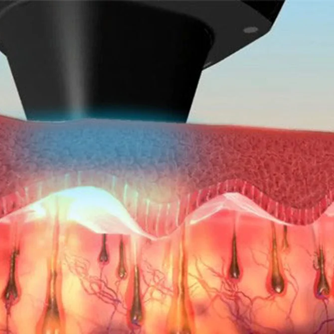 高度な冷却システム技術
