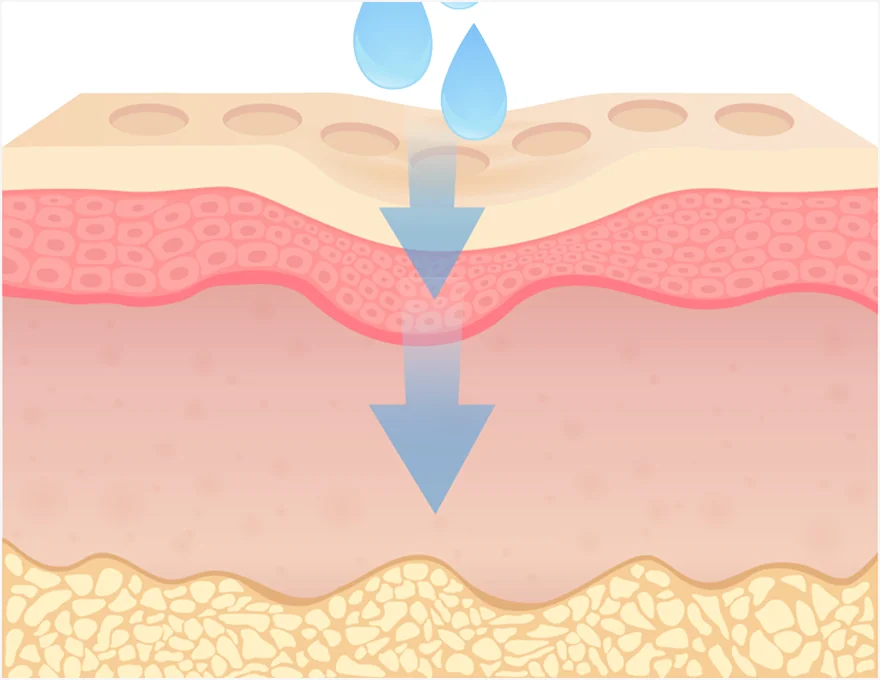 ジュベールック施術1段階の安全な注入