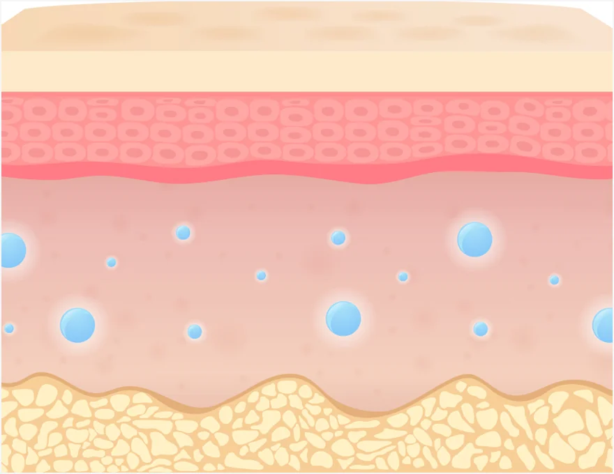 ジュベールック施術 3段階の皮膚修復