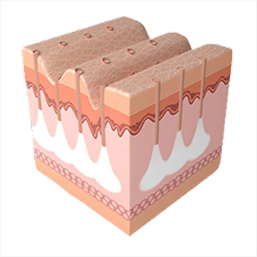 ミラジェットの施術過程3