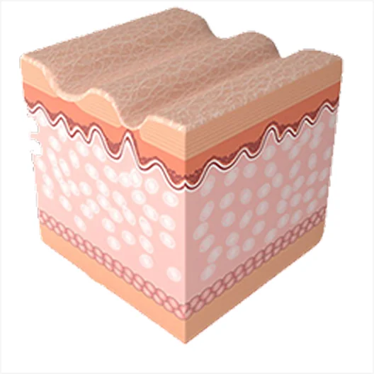 ミラジェットの施術過程4