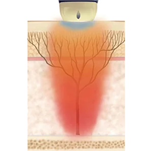 STACKモード - 強力なリフティング、引き締め、ブライトニング効果