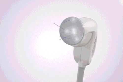 3D立体超音波システム