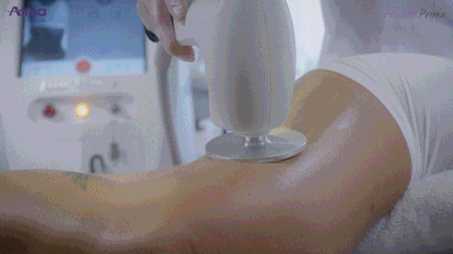 簡易無麻酔施術システム