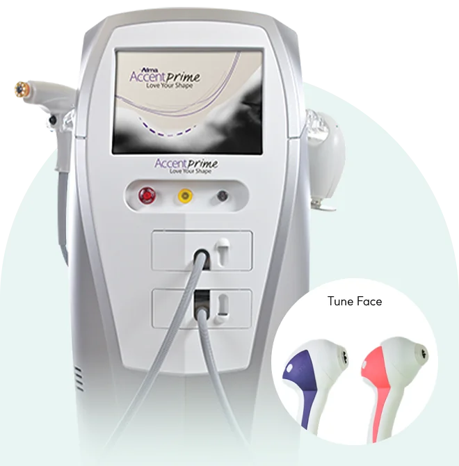 チューンフェイスのヒントと装備