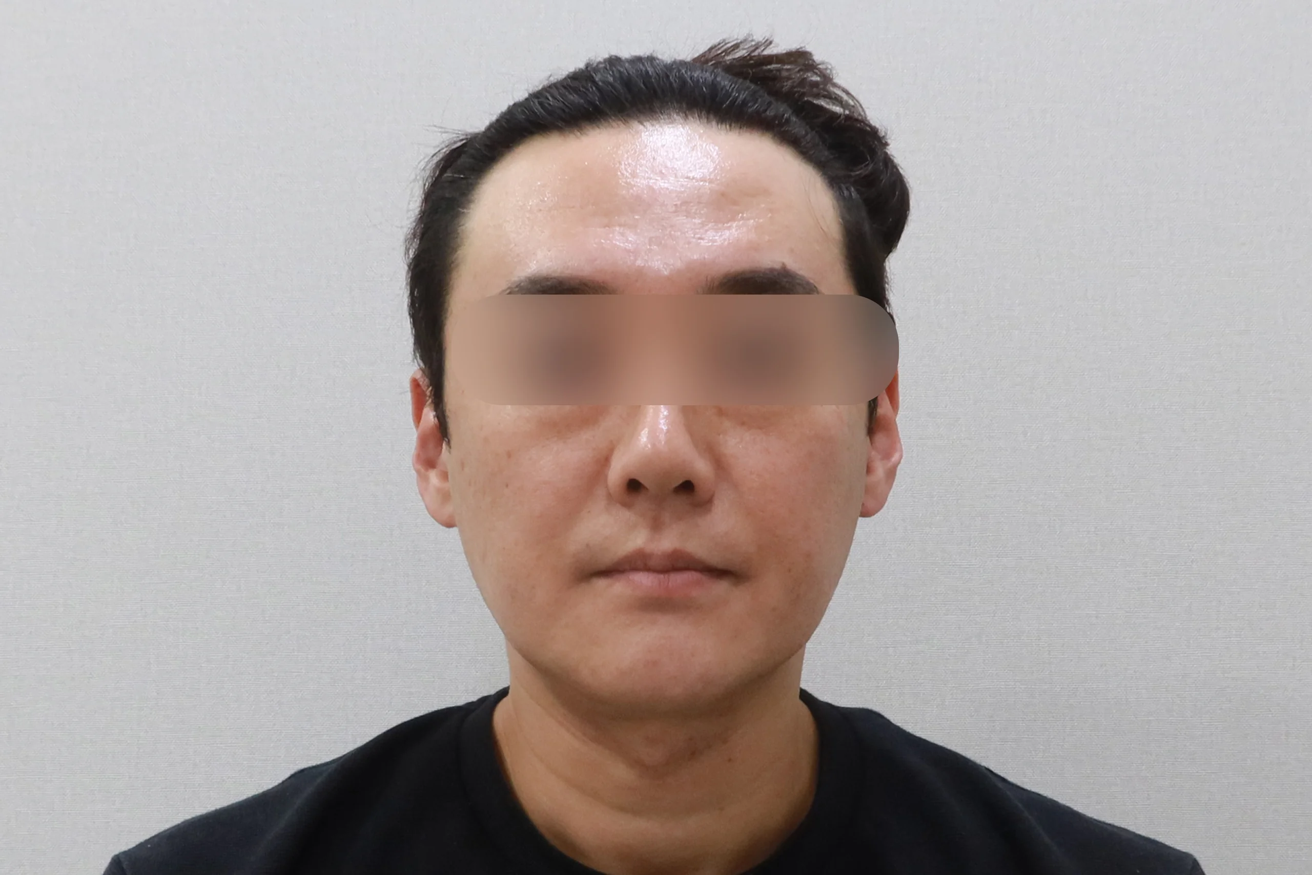 顔面消しゴム正面前