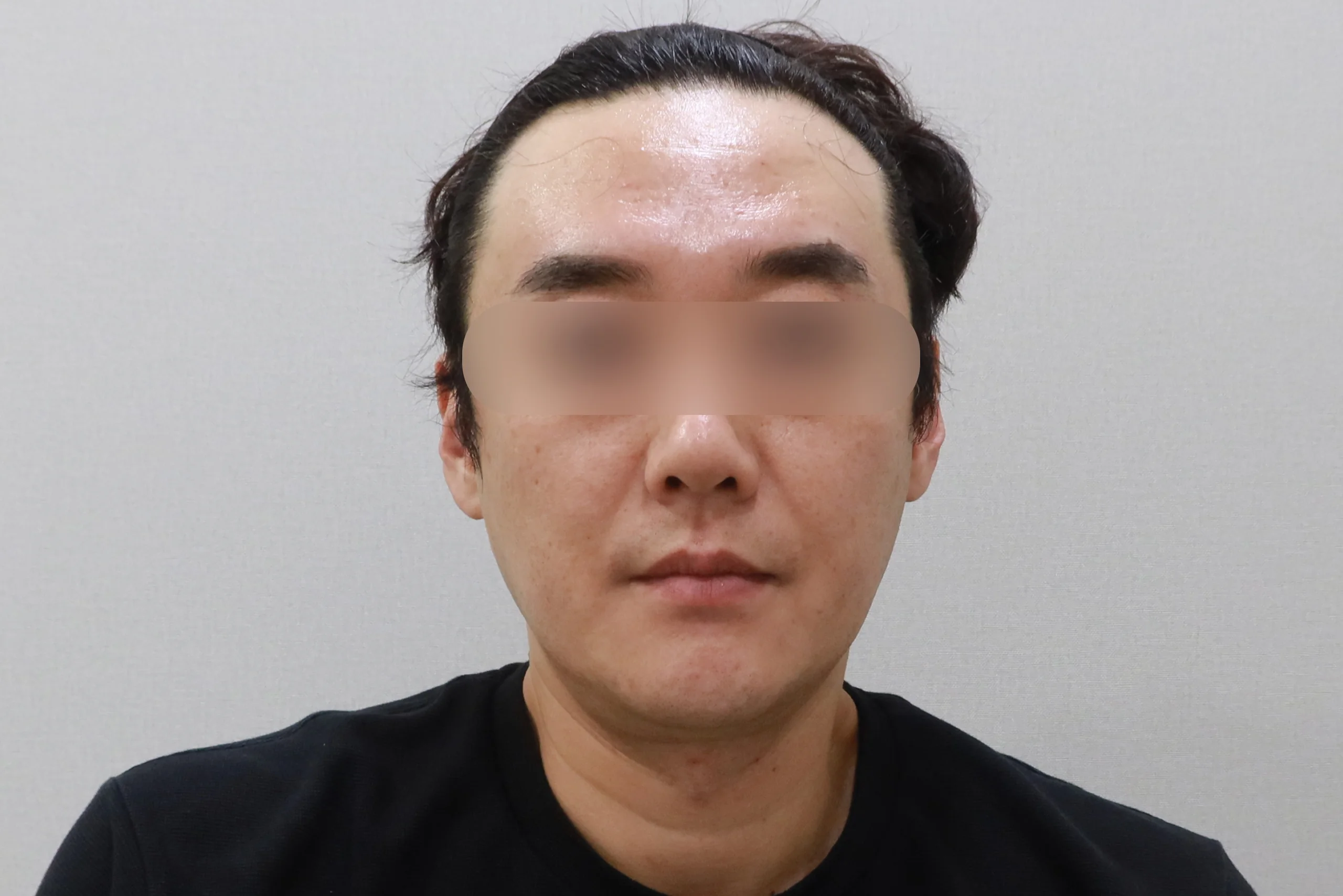 顔面消しゴム正面後